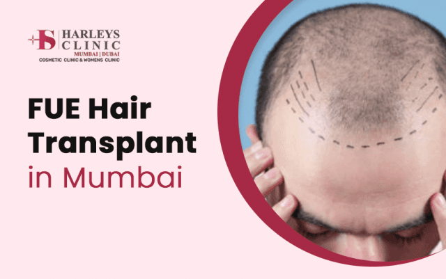 What Benefits Does FUE Hair Transplant Provide? 