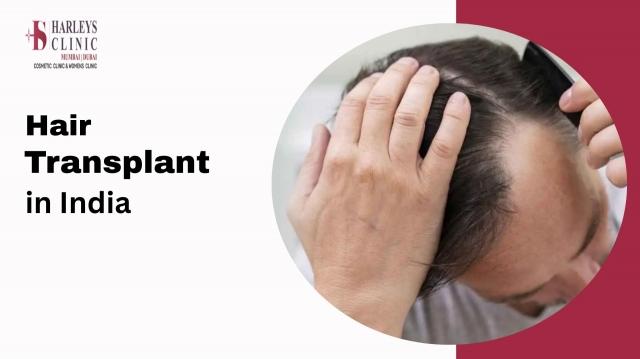 Factors Affecting Cost of Hair Transplants